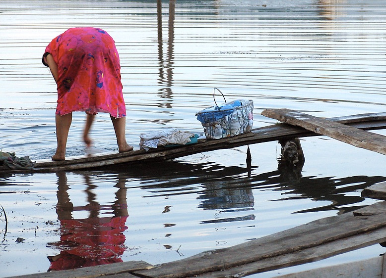 О варикозе, растяжках, лишнем весе и молодости лица