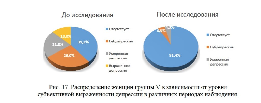 Депрессия